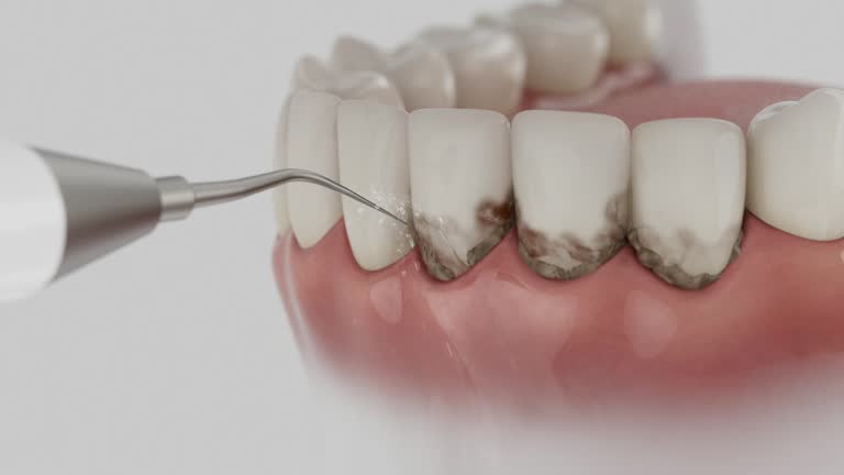 Reliable Emergency Dentist contractor in Ladera Ranch, CA by Smile Center Dentistry